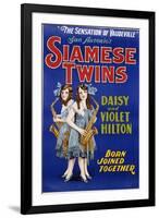 Poster Advertisement for Siamese Twins Daisy and Violet Hilton-null-Framed Premium Giclee Print
