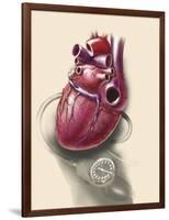 Posterior View of Human Heart on Photo of Blood Pressure Cuff-null-Framed Art Print