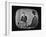 Presidential Candidate Richard M. Nixon Speaking During a Televised Debate-Paul Schutzer-Framed Photographic Print