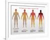 Progression of Ebola, Illustration-Gwen Shockey-Framed Giclee Print