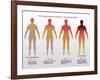 Progression of Ebola, Illustration-Gwen Shockey-Framed Giclee Print