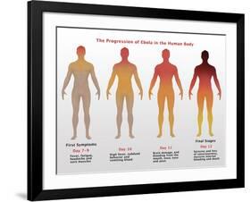 Progression of Ebola, Illustration-Gwen Shockey-Framed Giclee Print