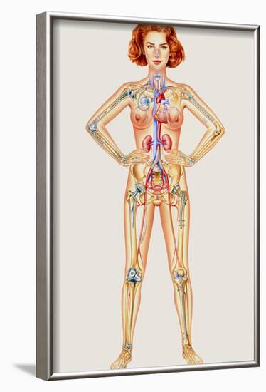 Prosthetic Woman: Artwork of Artificial Implants-John Bavosi-Framed Photographic Print