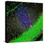 Purkinje Nerve Cell-David Becker-Stretched Canvas