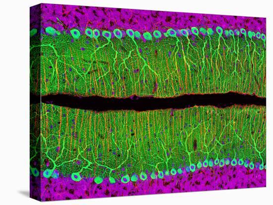 Purkinje Nerve Cells In the Cerebellum-Thomas Deerinck-Stretched Canvas