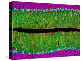 Purkinje Nerve Cells In the Cerebellum-Thomas Deerinck-Stretched Canvas