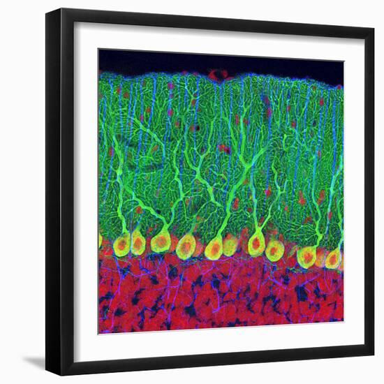 Purkinje Nerve Cells In the Cerebellum-Thomas Deerinck-Framed Premium Photographic Print