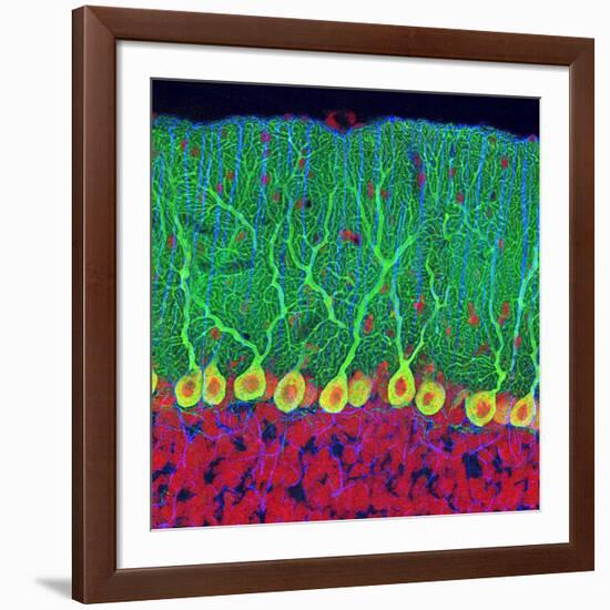 Purkinje Nerve Cells In the Cerebellum-Thomas Deerinck-Framed Photographic Print