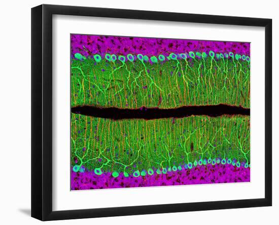 Purkinje Nerve Cells In the Cerebellum-Thomas Deerinck-Framed Photographic Print