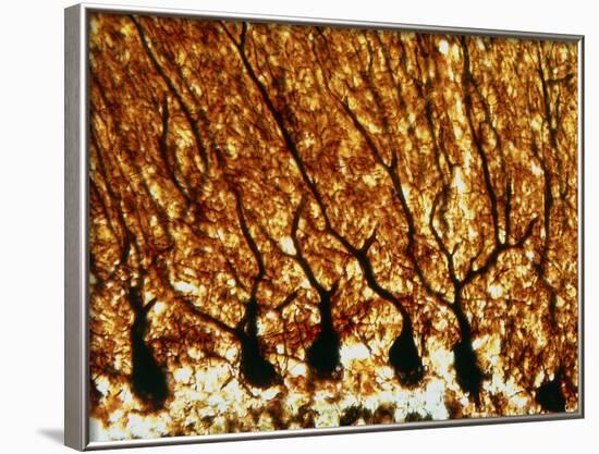 Purkinje Nerve Cells-null-Framed Photographic Print