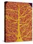 Rat Brain Blood Vessels, SEM-Susumu Nishinaga-Stretched Canvas