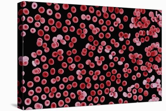 Red Blood Cells, SEM-Dr. Yorgos Nikas-Stretched Canvas
