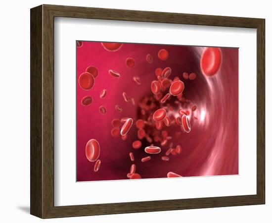 Red Blood Cells-David Mack-Framed Premium Photographic Print