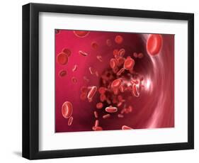 Red Blood Cells-David Mack-Framed Premium Photographic Print