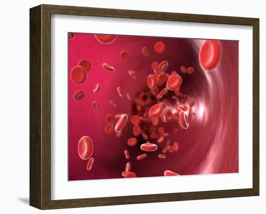 Red Blood Cells-David Mack-Framed Photographic Print