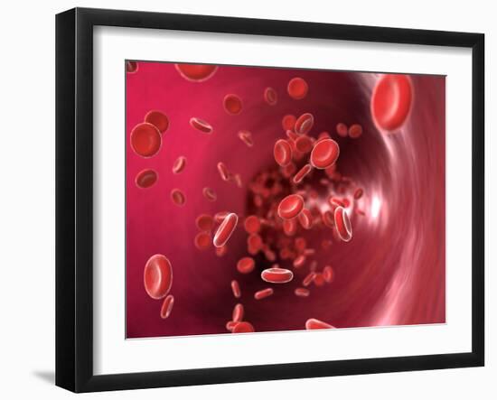 Red Blood Cells-David Mack-Framed Photographic Print