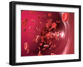 Red Blood Cells-David Mack-Framed Photographic Print