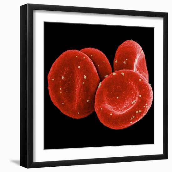 Red Blood Cells-null-Framed Photographic Print