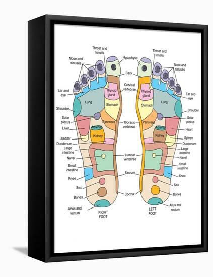 Reflexology Foot Map, Artwork-Peter Gardiner-Framed Stretched Canvas