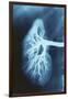 Renal Blood Vessels, X-ray-null-Framed Photographic Print