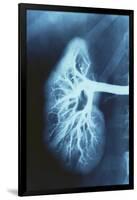 Renal Blood Vessels, X-ray-null-Framed Photographic Print