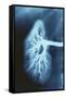 Renal Blood Vessels, X-ray-null-Framed Stretched Canvas