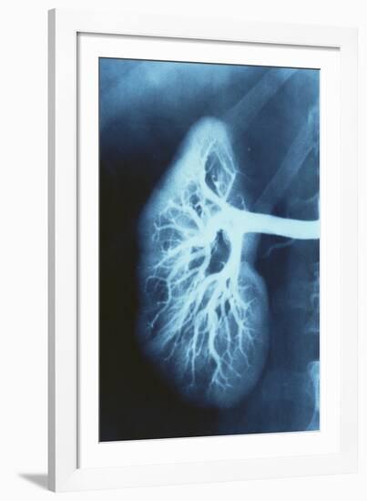 Renal Blood Vessels, X-ray-null-Framed Photographic Print