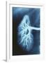 Renal Blood Vessels, X-ray-null-Framed Photographic Print