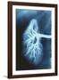 Renal Blood Vessels, X-ray-null-Framed Photographic Print