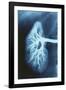 Renal Blood Vessels, X-ray-null-Framed Photographic Print