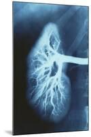 Renal Blood Vessels, X-ray-null-Mounted Photographic Print