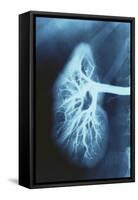 Renal Blood Vessels, X-ray-null-Framed Stretched Canvas