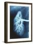 Renal Blood Vessels, X-ray-null-Framed Photographic Print