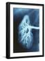 Renal Blood Vessels, X-ray-null-Framed Photographic Print