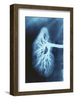 Renal Blood Vessels, X-ray-null-Framed Photographic Print