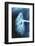 Renal Blood Vessels, X-ray-null-Framed Photographic Print