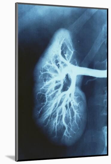 Renal Blood Vessels, X-ray-null-Mounted Photographic Print