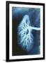 Renal Blood Vessels, X-ray-null-Framed Premium Photographic Print