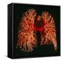 Resin Cast of Pulmonary Arteries And Bronchi-Martin Dohrn-Framed Stretched Canvas