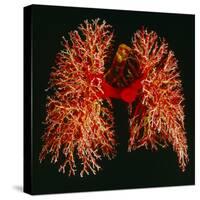Resin Cast of Pulmonary Arteries And Bronchi-Martin Dohrn-Stretched Canvas
