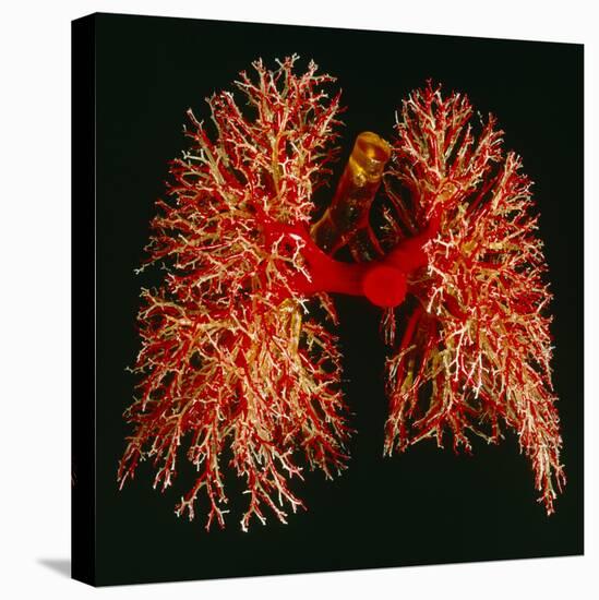 Resin Cast of Pulmonary Arteries And Bronchi-Martin Dohrn-Stretched Canvas