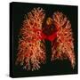 Resin Cast of Pulmonary Arteries And Bronchi-Martin Dohrn-Stretched Canvas