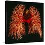 Resin Cast of Pulmonary Arteries And Bronchi-Martin Dohrn-Stretched Canvas