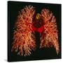 Resin Cast of Pulmonary Arteries And Bronchi-Martin Dohrn-Stretched Canvas