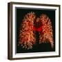 Resin Cast of Pulmonary Arteries And Bronchi-Martin Dohrn-Framed Premium Photographic Print