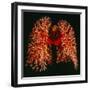 Resin Cast of Pulmonary Arteries And Bronchi-Martin Dohrn-Framed Premium Photographic Print