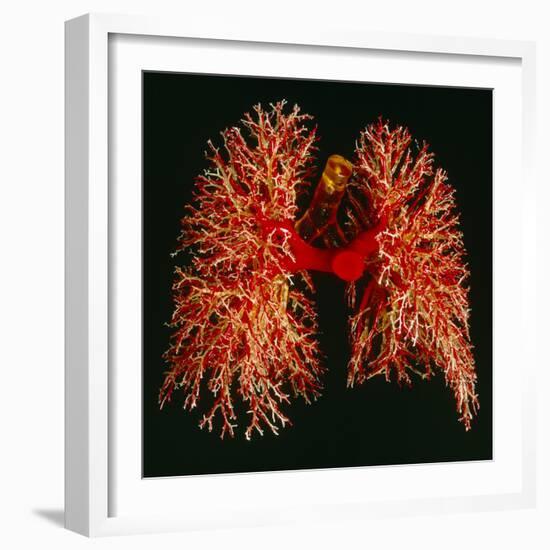 Resin Cast of Pulmonary Arteries And Bronchi-Martin Dohrn-Framed Premium Photographic Print