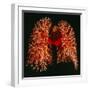 Resin Cast of Pulmonary Arteries And Bronchi-Martin Dohrn-Framed Premium Photographic Print