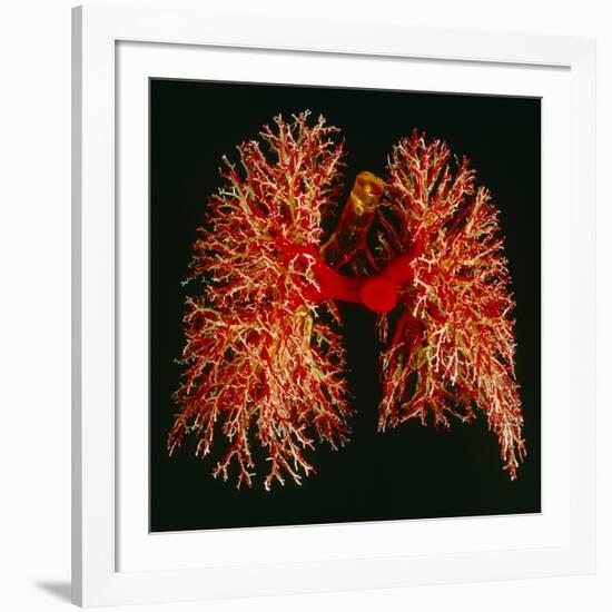 Resin Cast of Pulmonary Arteries And Bronchi-Martin Dohrn-Framed Photographic Print