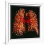 Resin Cast of Pulmonary Arteries And Bronchi-Martin Dohrn-Framed Photographic Print